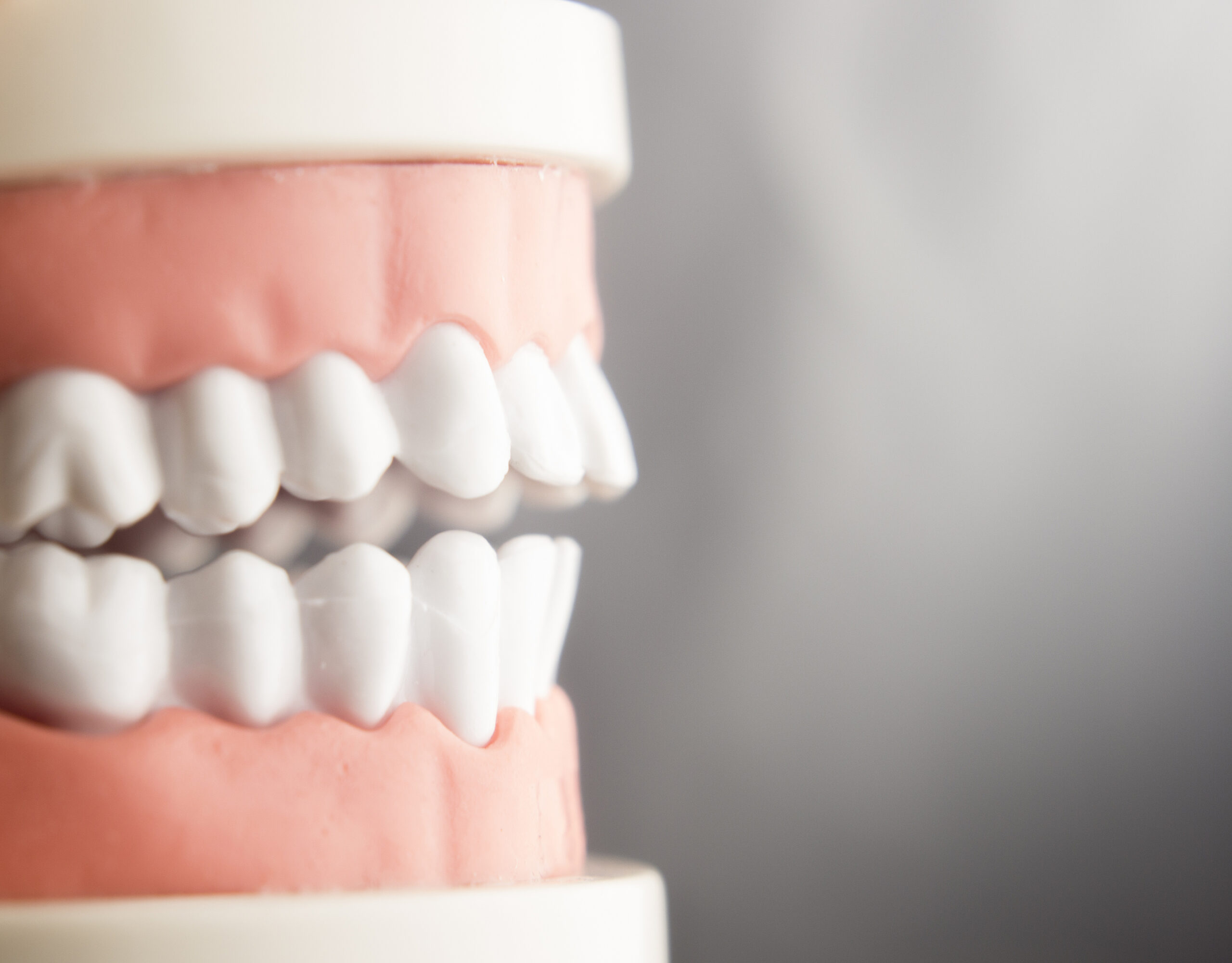 Why Does Suboxone Cause Tooth Decay? | Lawsuit Legal News 