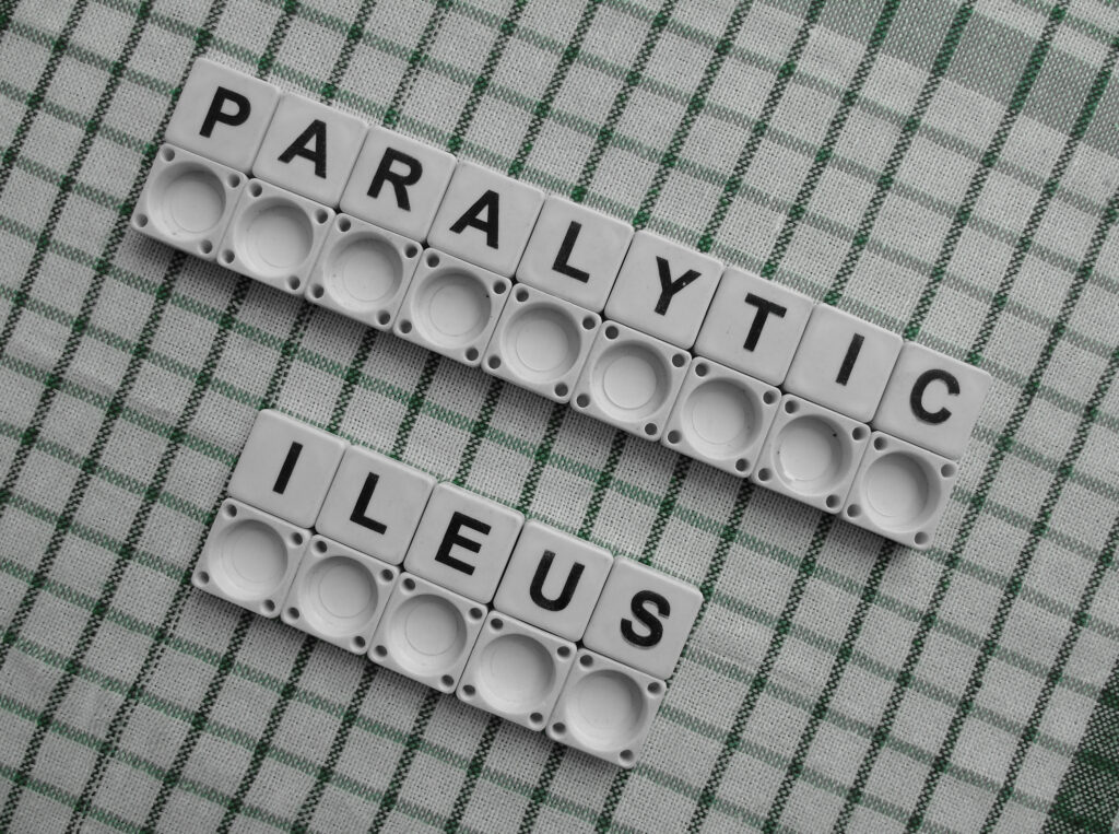 Paralytic Ileus