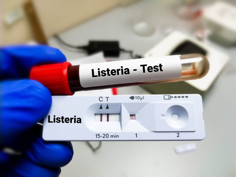 Test tube and rapid test cassette for Listeria bacteria test, diagnosis for Listeriosis - LLN