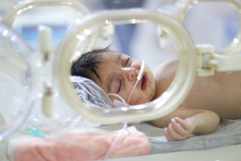 A close-up of a sleeping infant in a hospital incubator with medical tubing, representing the critical care and long-term health monitoring required for babies suffering from Neocate-linked bone fractures and rickets.
